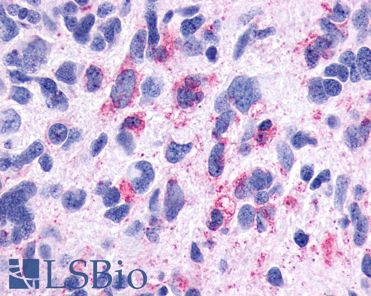 PathPlus™ Polyclonal Rabbit anti-Human TACR3 / NK3R Antibody (N-Terminus, IHC)