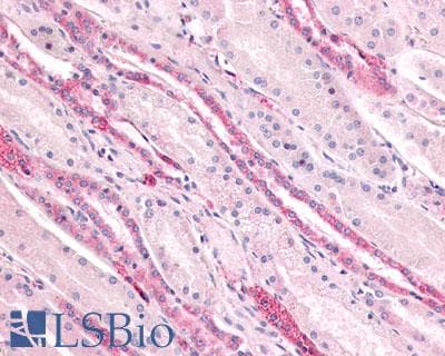 PathPlus™ Polyclonal Rabbit anti-Human GPR4 Antibody (Extracellular Domain, IHC)