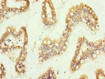 Polyclonal Rabbit anti-Human TRIM10 Antibody (IHC)