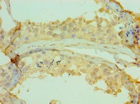 CETN2 / Centrin 2 Antibody (aa1-172)