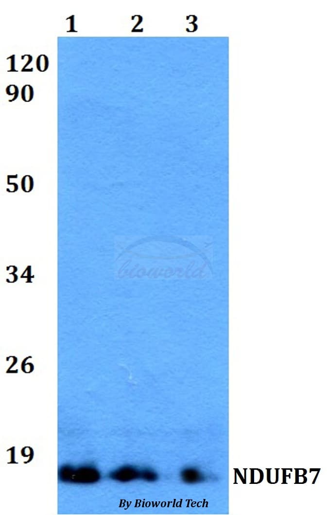 Polyclonal Rabbit anti-Human NDUFB7 / B18 Antibody (WB)