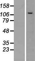 CWC22 Protein (Over-Expression Lysate Myc-DDK (Flag))