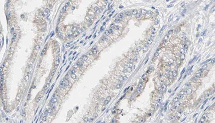 CALM3 / Calmodulin 3 Antibody