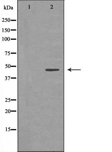 RRM2 Antibody