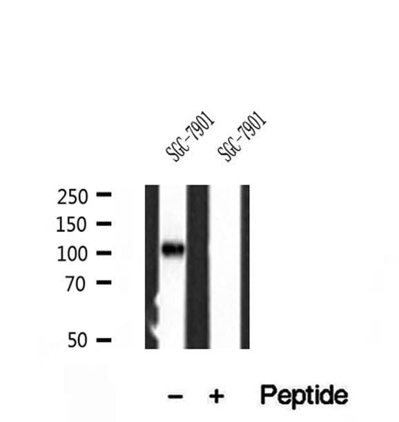 Polyclonal Rabbit anti-Human PPP1R15B Antibody (IHC, WB)