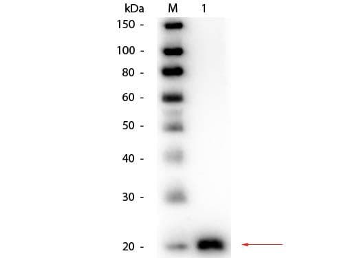 Polyclonal Rabbit anti-Human VEGFA / VEGF Antibody (Biotin, IHC, WB)