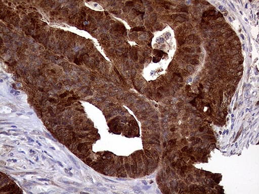 ASS1 / ASS Antibody (C-Terminus, clone OTI8H4)