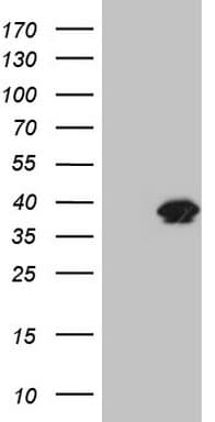 KLK3 / PSA Antibody (aa25-261, clone OTI1F7, Carrier-free)