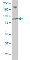 RNF139 / TRC8 Antibody (clone 3D10)