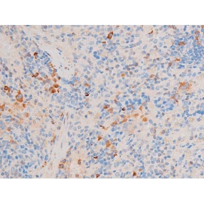 FOXO4 / AFX1 Antibody (phospho-Ser197)