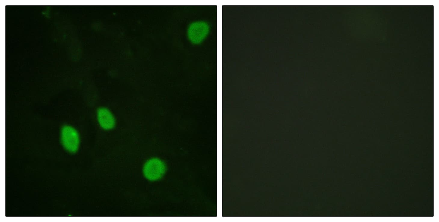 Polyclonal Rabbit anti-Human CCNH / Cyclin H Antibody (aa274-323, IHC, IF, WB)
