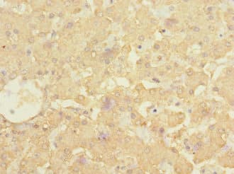 ALCAM / CD166 Antibody