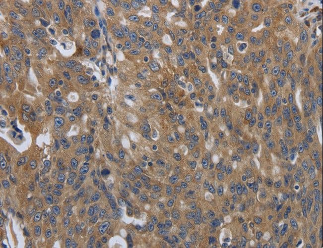 Polyclonal Rabbit anti-Human SOCS1 Antibody (IHC, WB)