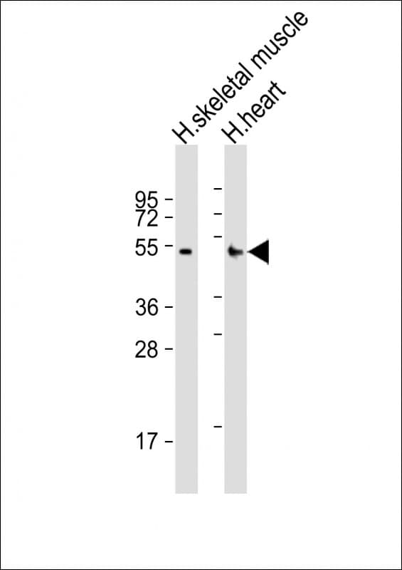 RHBDL1 Antibody (aa148-182)