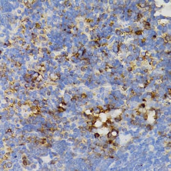 PTPN11 / SHP-2 / NS1 Antibody