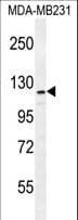 ADAMTS18 Antibody (aa1066-1095)