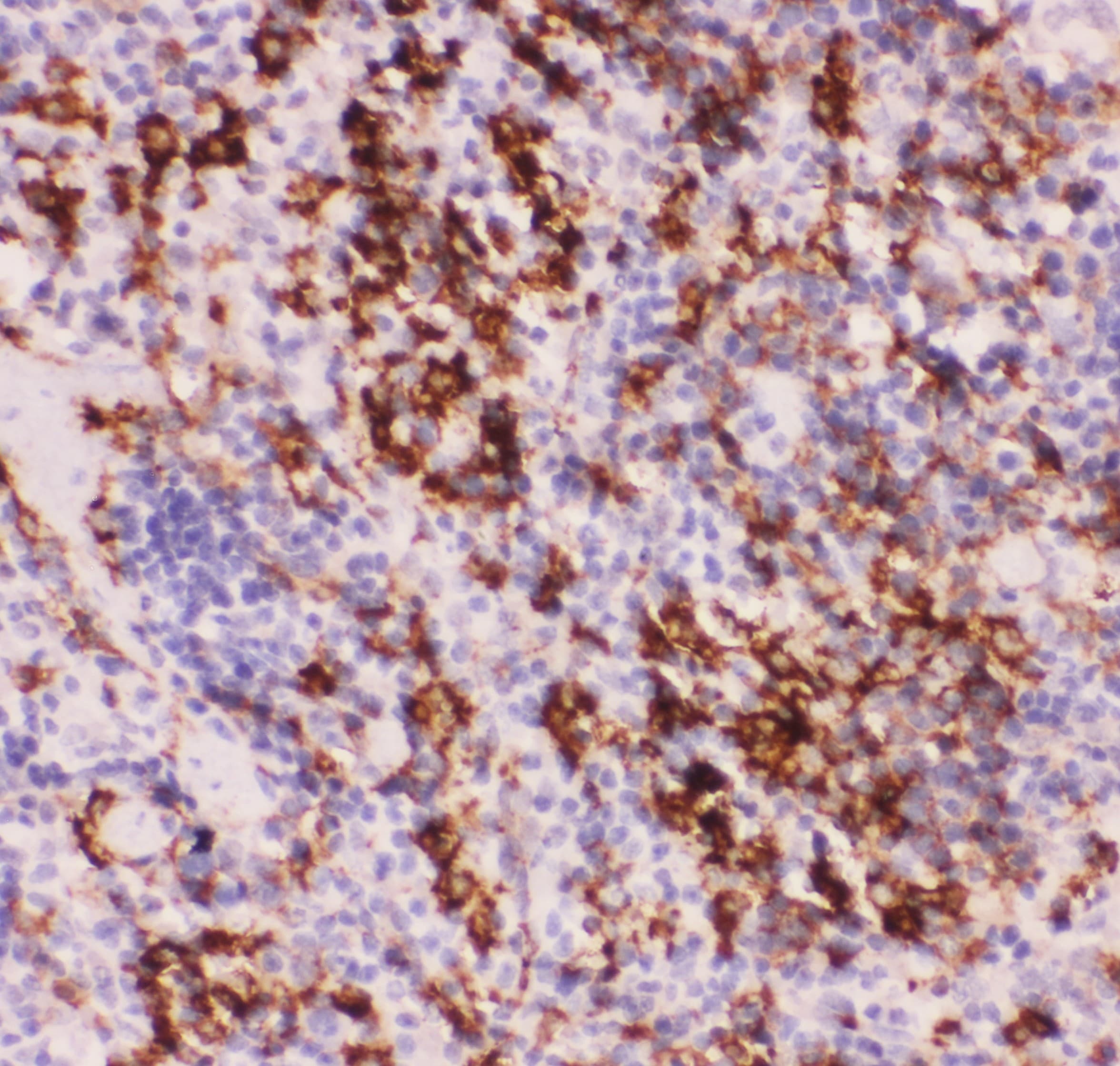 Polyclonal Rabbit anti-Human MYD88 Antibody (aa44-264, IHC, WB)