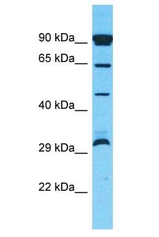 Polyclonal Rabbit anti-Human OR10P1 Antibody (aa251-300, WB)