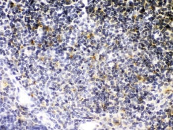 TNFRSF1B / TNFR2 Antibody