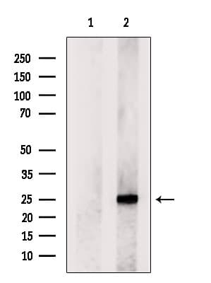 Polyclonal Rabbit anti-Human MXD1 / MAD1 Antibody (WB)