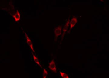MRPS21 Antibody