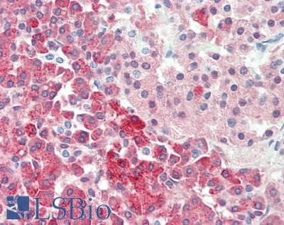 IHC-plus™ Polyclonal Rabbit anti-Human CPB / Carboxypeptidase B Antibody (IHC)