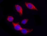 IHC-plus™ Monoclonal Mouse anti-Human KRT18 / CK18 / Cytokeratin 18 Antibody (clone DA-7, IHC, WB)