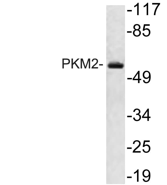 PKM / Pyruvate Kinase, Muscle Antibody (aa181-230)