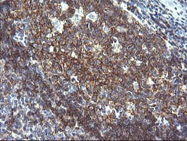 CD19 Antibody (clone OTI1F2)