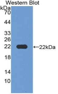 MAGP / MFAP2 Antibody (aa6-162)