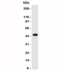KRT17 / CK17 / Cytokeratin 17 Antibody (clone SPM560)