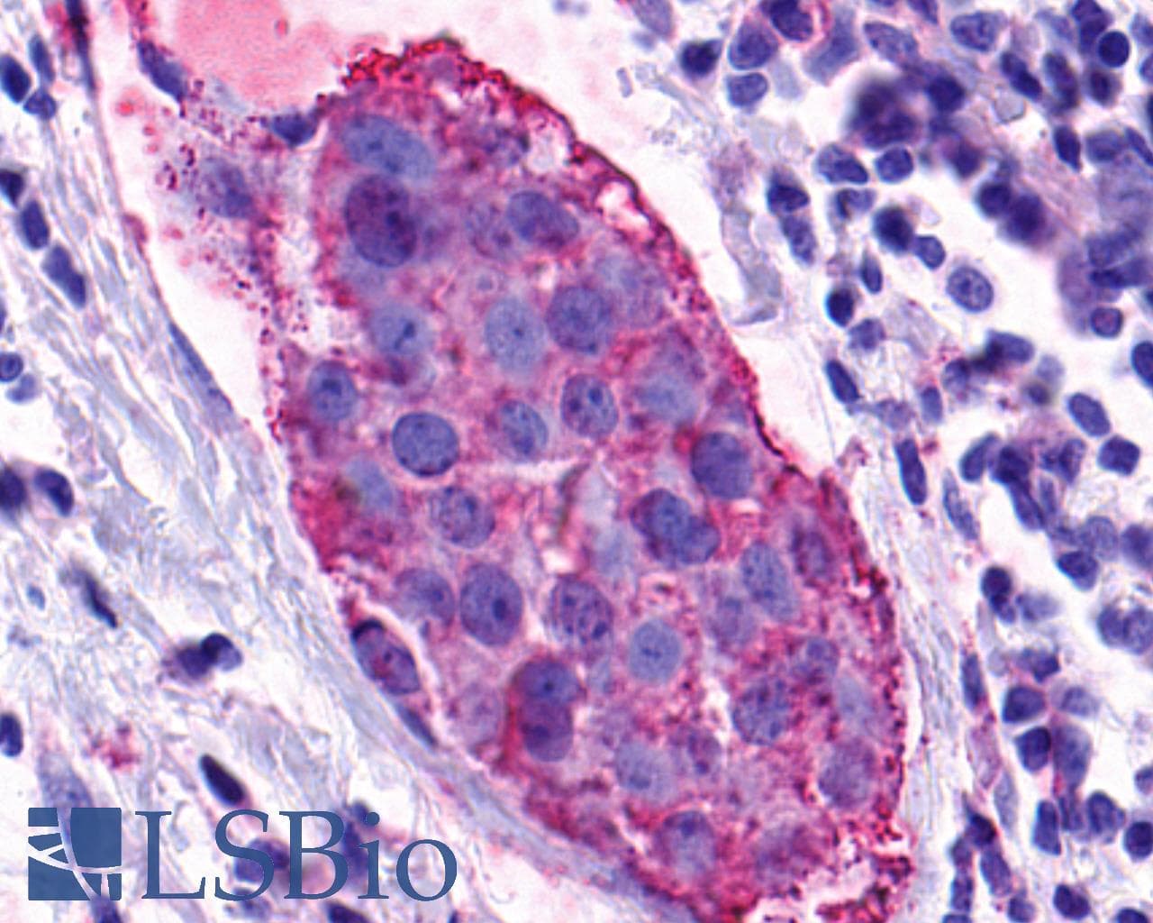 PathPlus™ GPR139 Antibody (Cytoplasmic Domain)