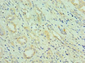 CETN2 / Centrin 2 Antibody (aa1-172)