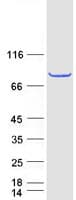 Human PRCC / RCCP1 Protein (Recombinant Myc-DDK (Flag))
