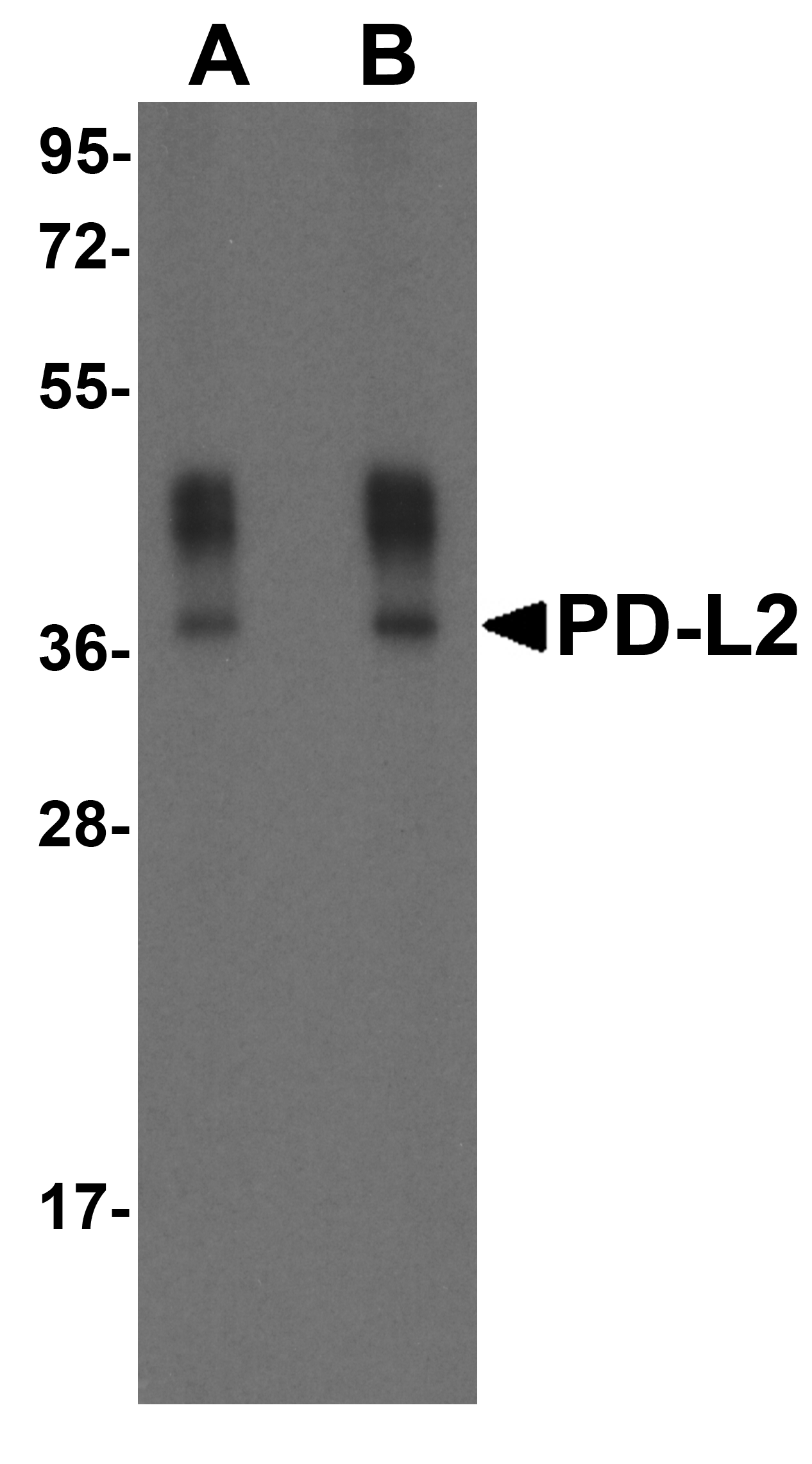 IHC-plus™ Monoclonal Mouse anti-Human PD-L2 / PDCD1LG2 / CD273 Antibody (clone 7C7, IHC, IF, WB)