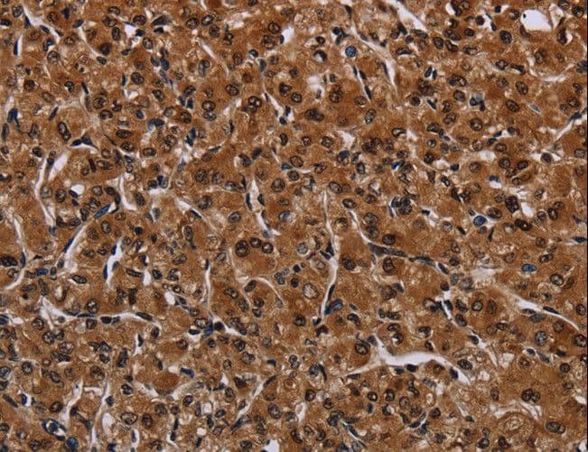 Polyclonal Rabbit anti-Human IRGM / LRG-47 Antibody (IHC, WB)