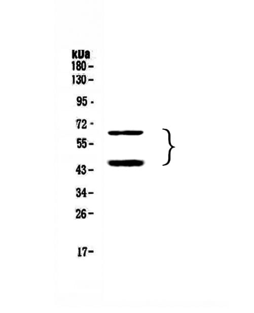 Polyclonal Rabbit anti-Human HAVCR2 / TIM-3 Antibody (WB)
