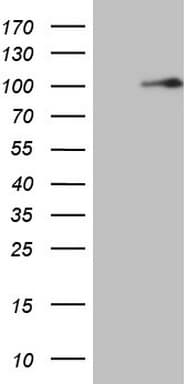 MTDH / Metadherin Antibody (aa70-582, clone OTI6H2)