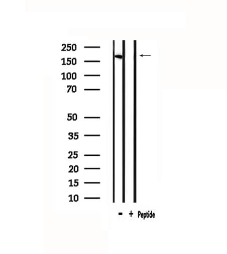 Polyclonal Rabbit anti-Human DEC-205 / CD205 / LY75 Antibody (IF, WB)