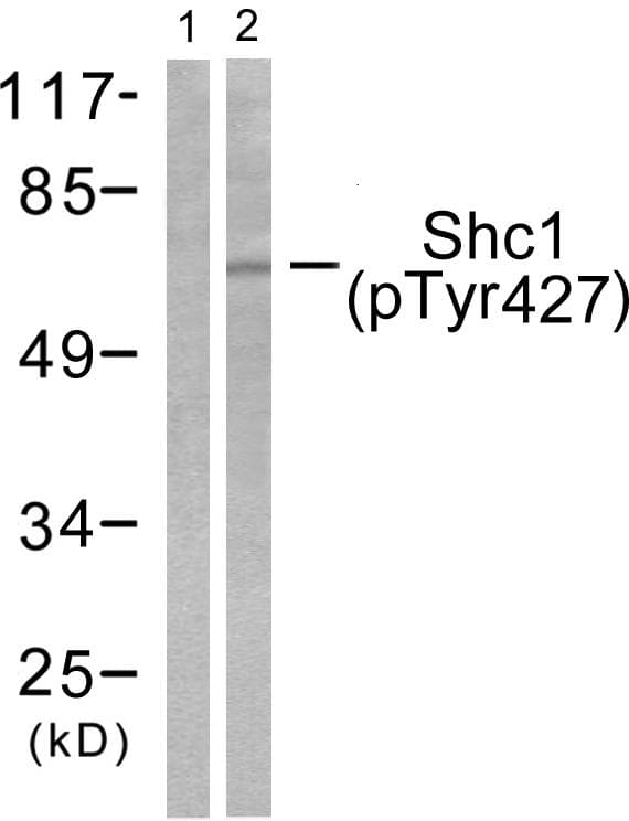 p66 / SHC Antibody (phospho-Tyr427)