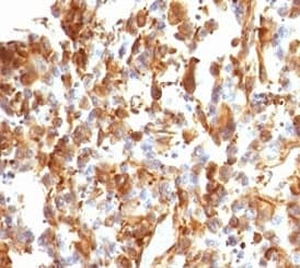 Vimentin Antibody (clone VIM66-1)