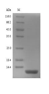 Human DEFB130 Protein (Recombinant 6His, N-terminus)