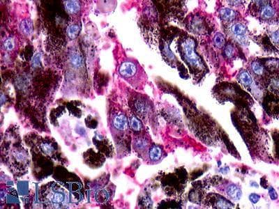 PathPlus™ Polyclonal Rabbit anti-Human RAIG2 / GPRC5B Antibody (C-Terminus, IHC)