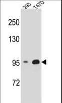 IHC-plus™ CTNNB1 / Beta Catenin Antibody (aa78-106)