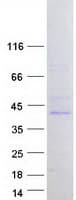 Human FBL8 / FBXL8 Protein (Recombinant Myc-DDK (Flag))