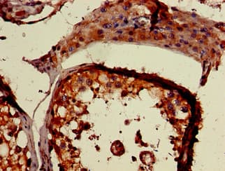 Polyclonal Rabbit anti-Human PLCD1 Antibody (IHC)