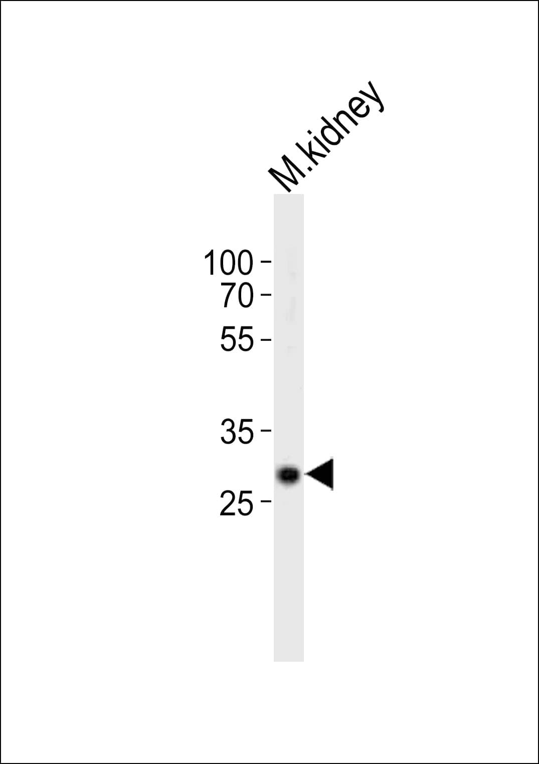 Polyclonal Rabbit anti-Mouse HES1 / HES-1 Antibody (aa102-137, WB)