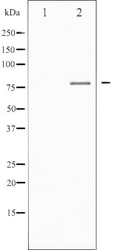 FOXO1 / FKHR Antibody
