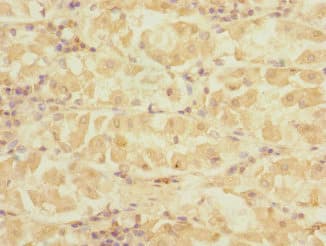 Polyclonal Rabbit anti-Human DET1 Antibody (IHC)