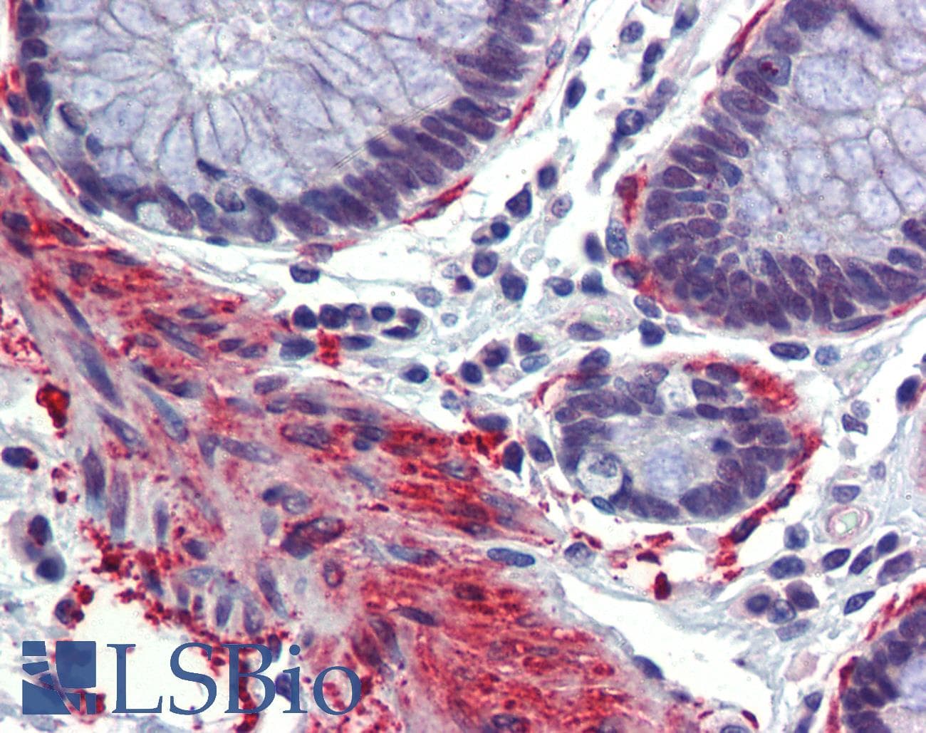 Polyclonal Rabbit anti-Human CREBBP / CREB Binding Protein Antibody (aa144-193, IHC, WB)